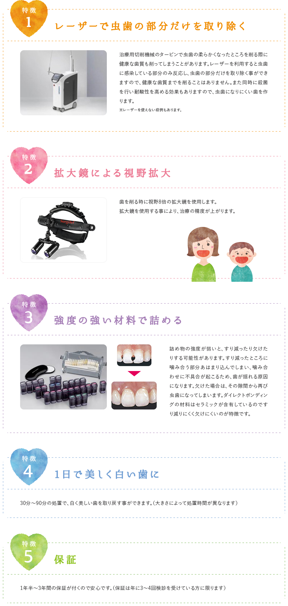 ダイレクトボンディング特徴