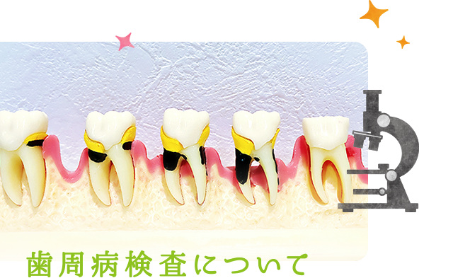 歯周病検査について
