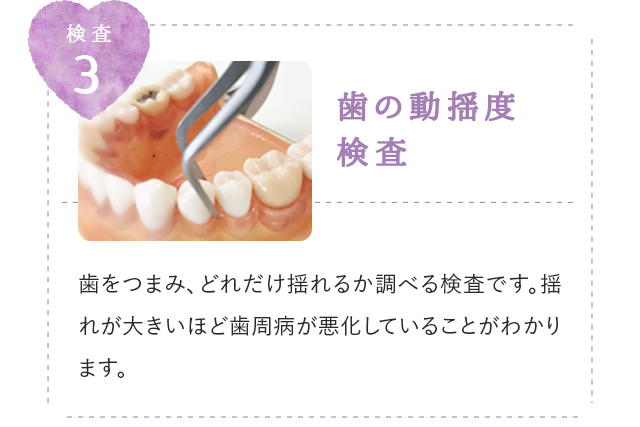歯の動揺検査